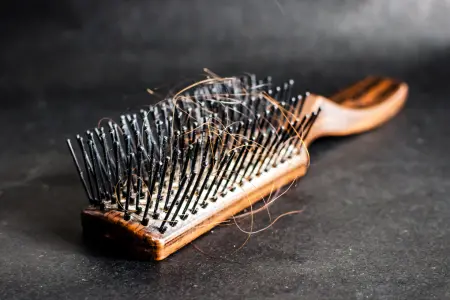 Haaruitval: oorzaak, behandeling en preventie